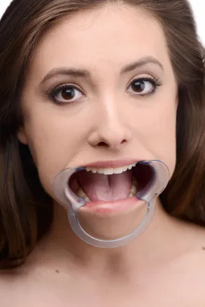 Cheek Retractor