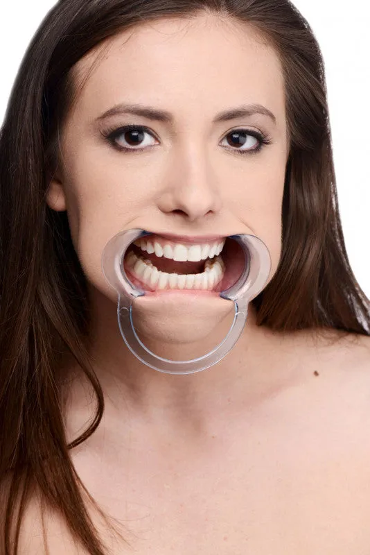 Cheek Retractor